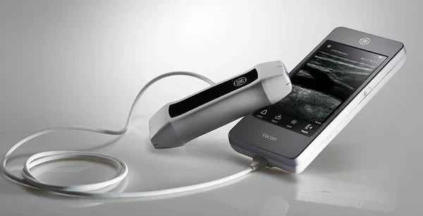 Portable Ultrasound System C10TX: Revolutionizing Point of Care Diagnostics Portable Ultrasound System C10TX: Revolutionizing Point of Care Diagnostics